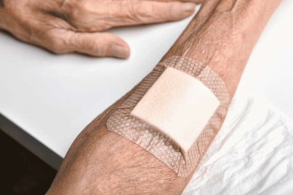 Soft Silicone Dressings, Gels & Adhesives–10 Incredible Healing Advantages  - Pharmaplast