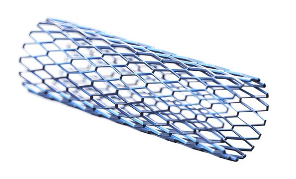 Illustration d’un stent